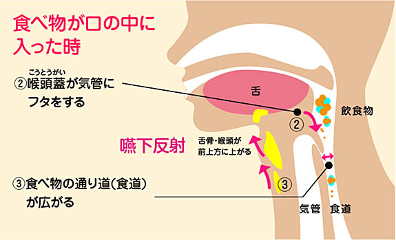 誤嚥